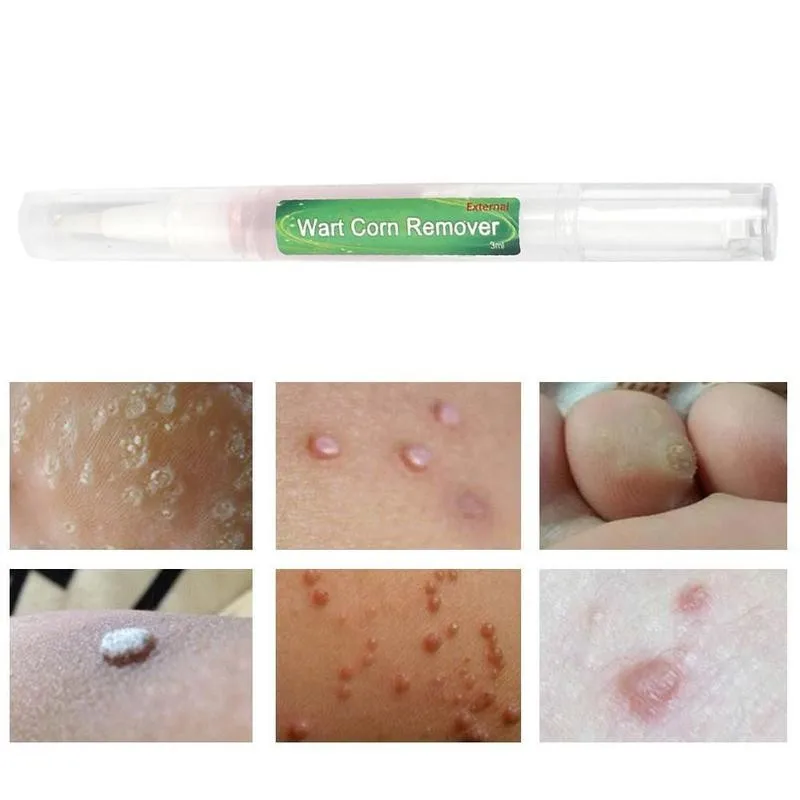Body Warts Treatment Cream Skin Tag Remover Brodawki Corn Patch Foot Foot Net, Brodawki Flat Care Cream Kukurudze Light 3ml Remover H5W1