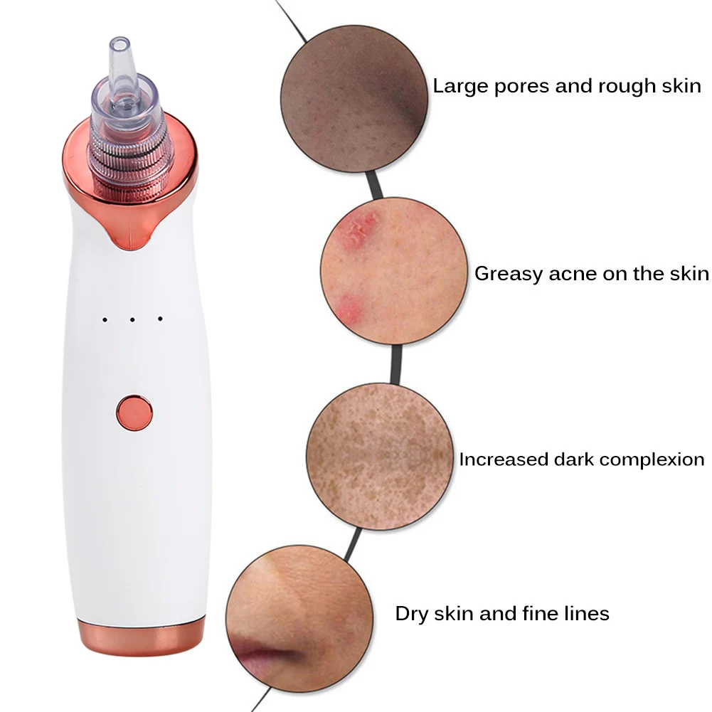 Blackhead Black Dot Remover Face Pore Vacuum Black Head Vacuum Extractor Suction Cleaner Twarzowy Tool Nose Clean Tool