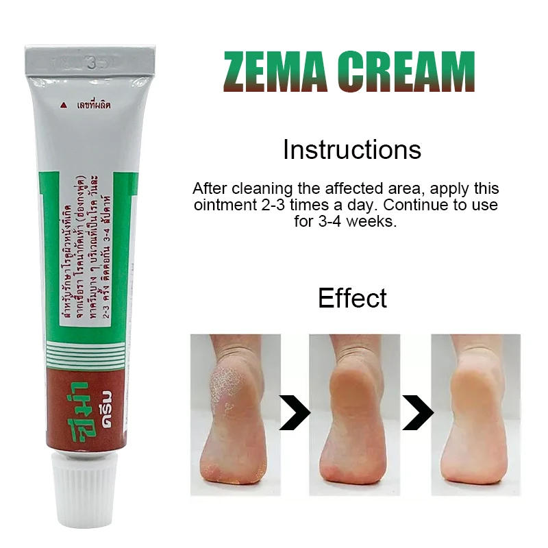 Tajlandia ZEMA Psoriasis Cream Herbal Anti-Bacterial For Anti-Itch Balm Leczy zapalenie Skóry Wyprysk, Świąd jakąś grzybicę